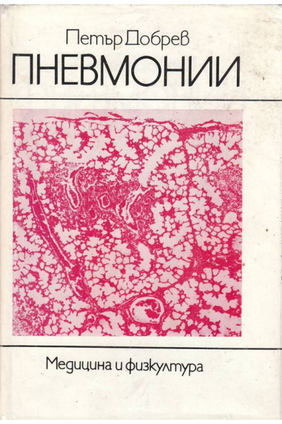 Пнвмонии