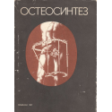 Остеосинтез